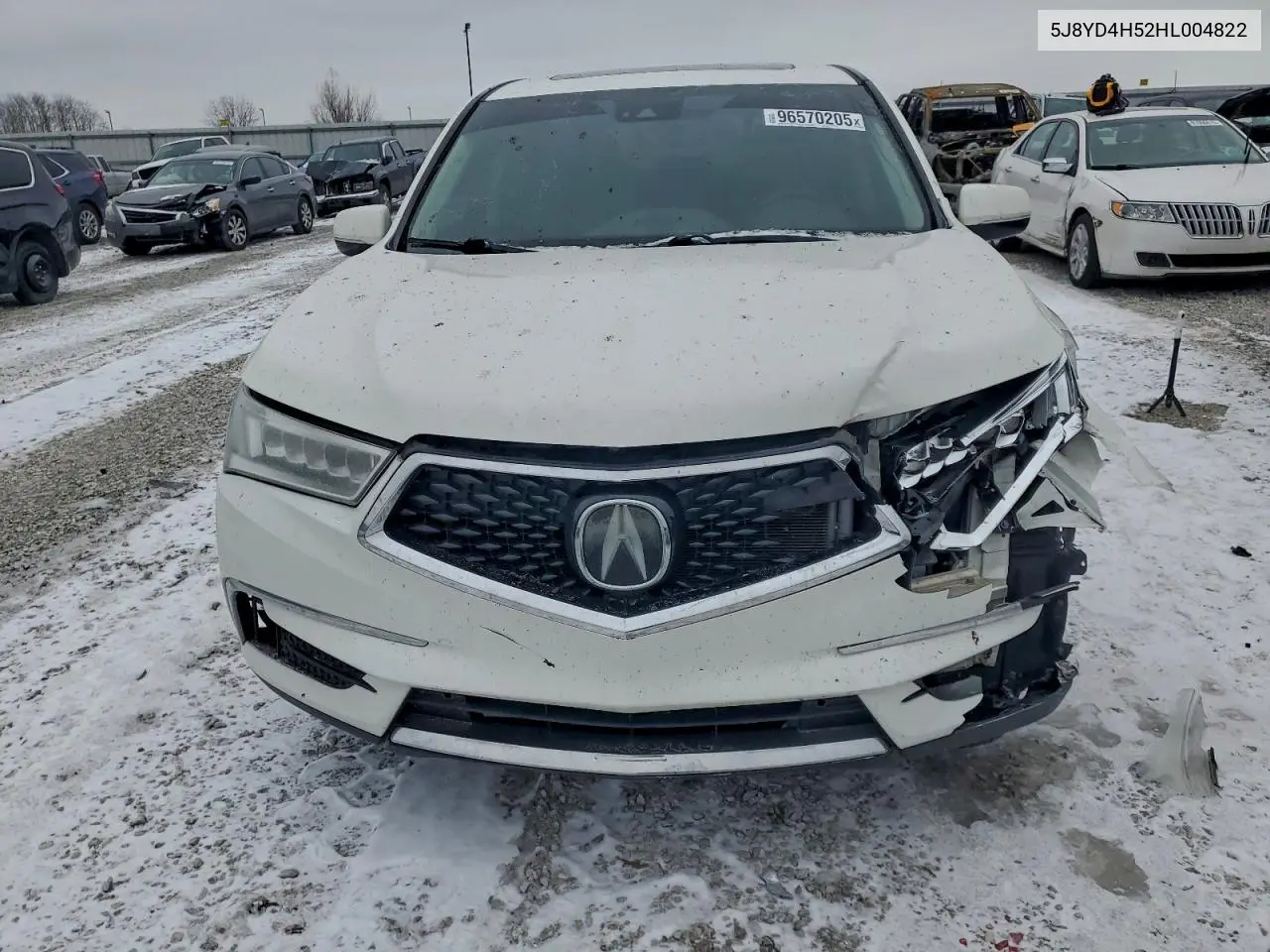 5J8YD4H52HL004822 2017 Acura Mdx Technology