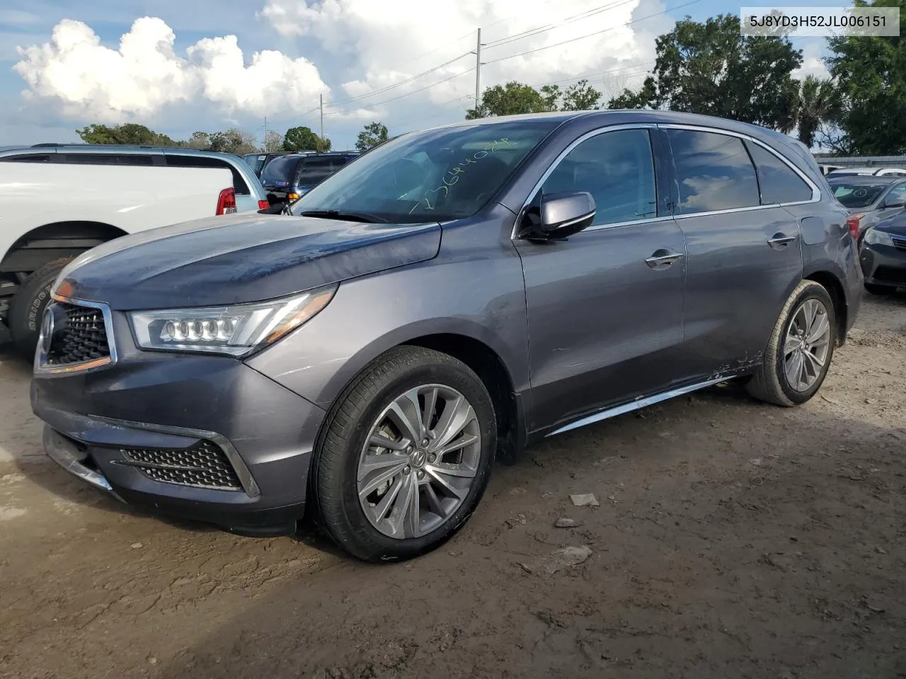 5J8YD3H52JL006151 2018 Acura Mdx Technology