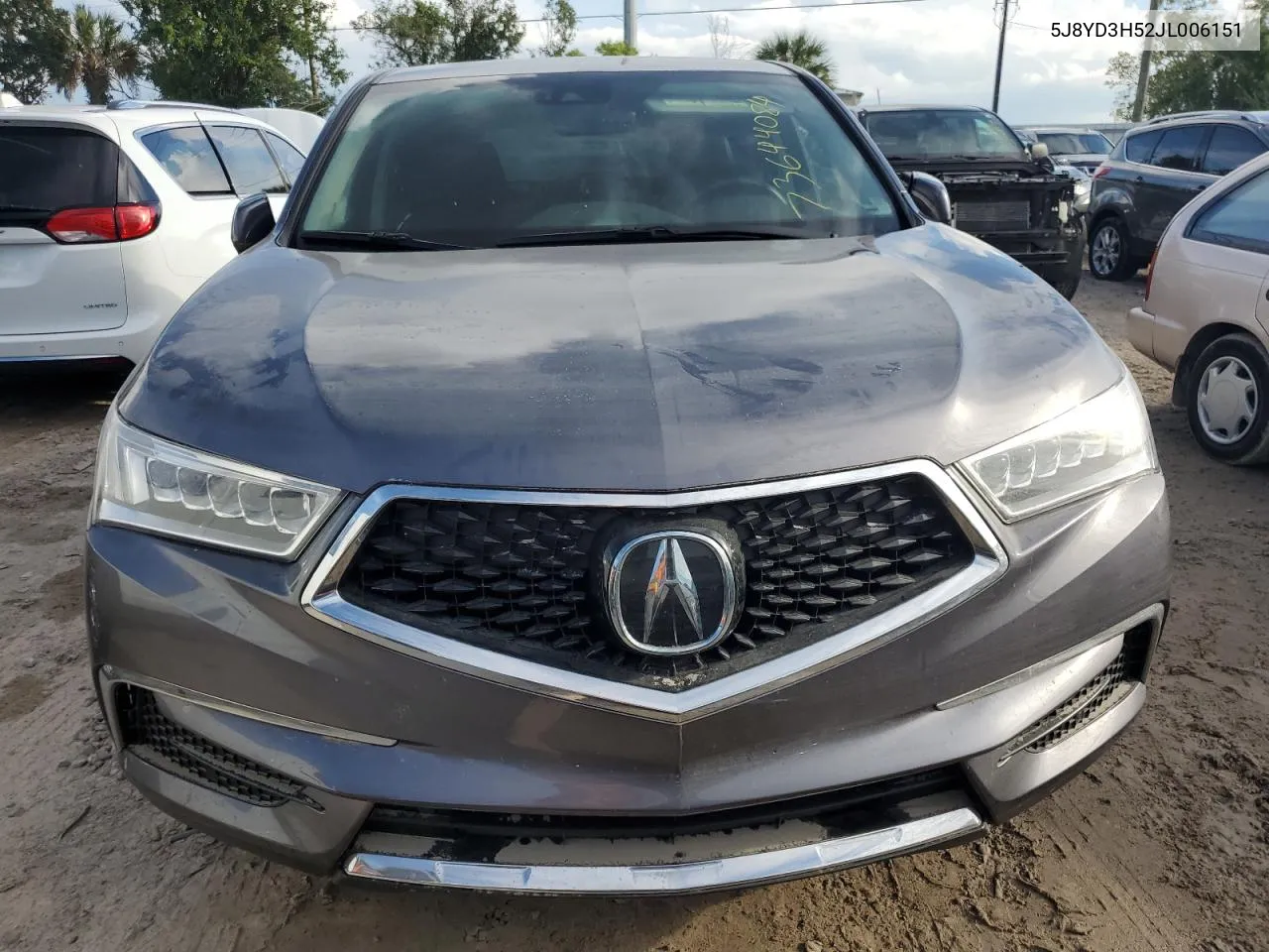 5J8YD3H52JL006151 2018 Acura Mdx Technology