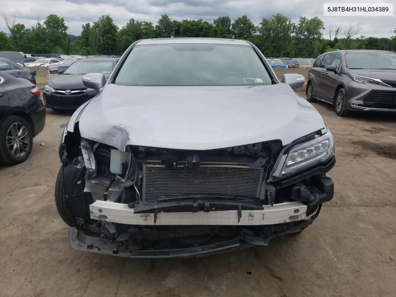 5J8TB4H31HL034389 2017 Acura Rdx