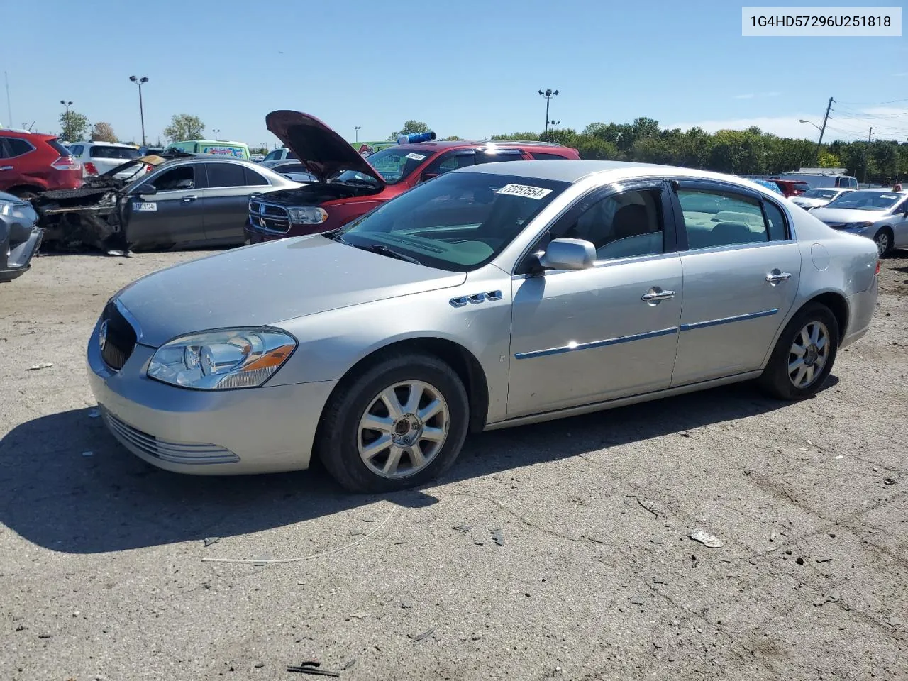 2006 Buick Lucerne Cxl VIN: 1G4HD57296U251818 Lot: 72257554