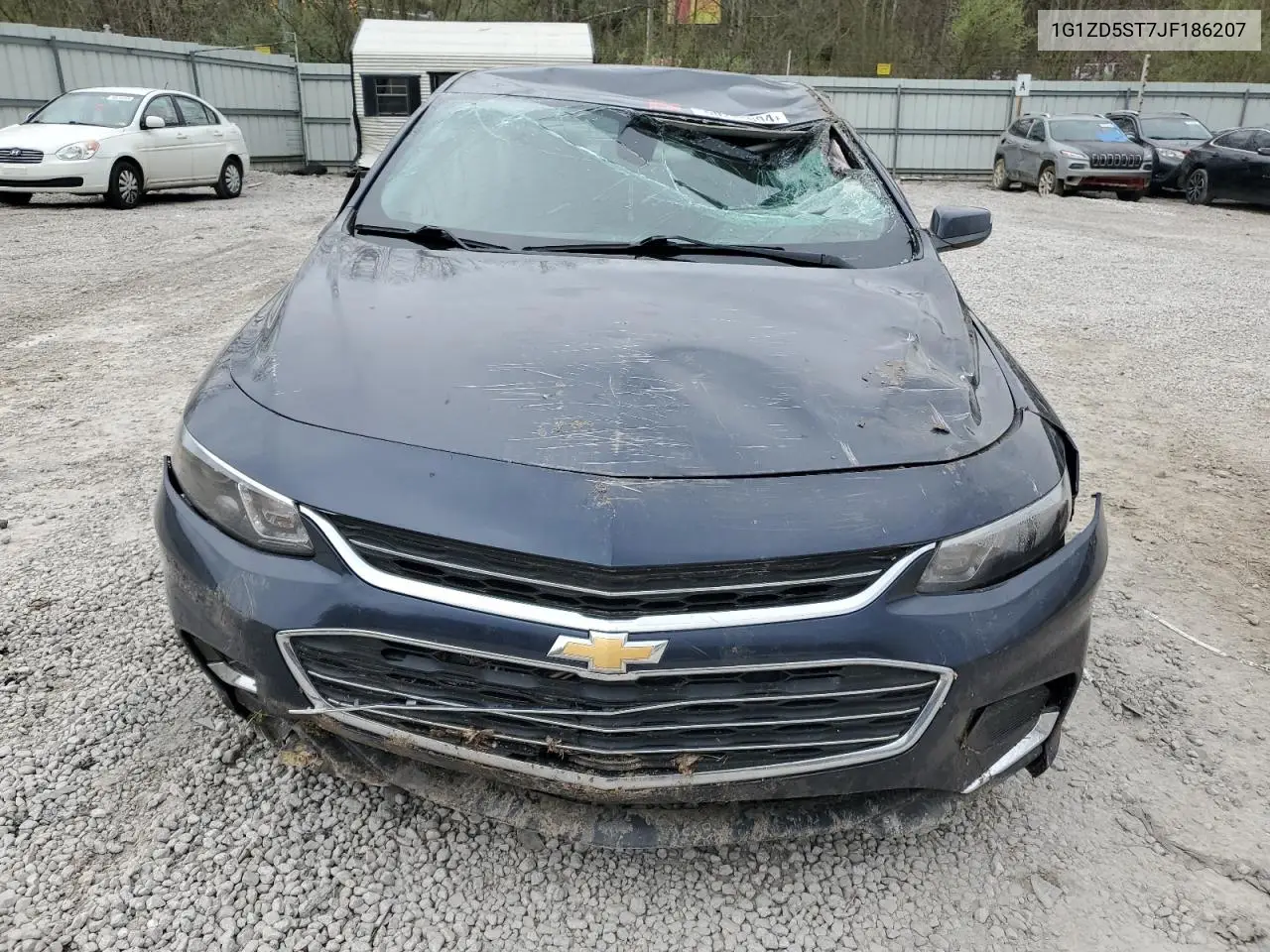 1G1ZD5ST7JF186207 2018 Chevrolet Malibu Lt