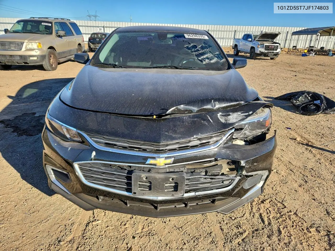 1G1ZD5ST7JF174803 2018 Chevrolet Malibu Lt