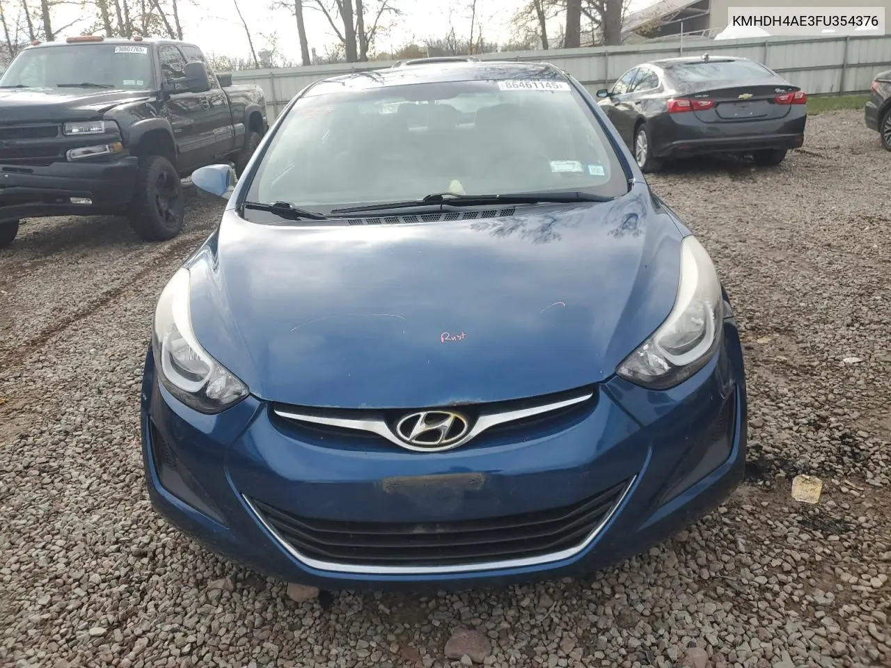 KMHDH4AE3FU354376 2015 Hyundai Elantra Se