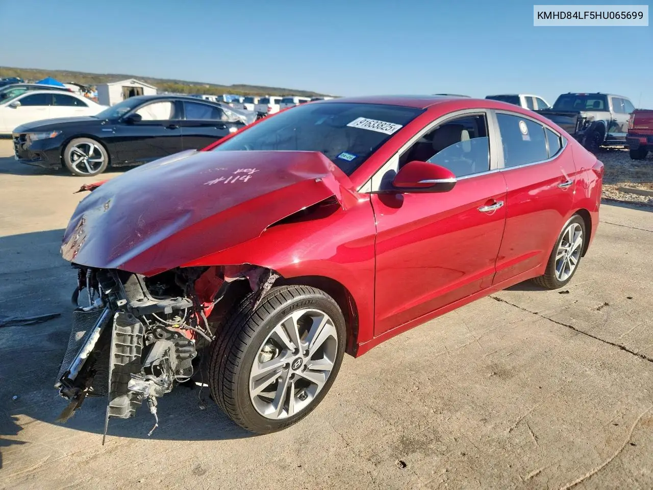 KMHD84LF5HU065699 2017 Hyundai Elantra Se