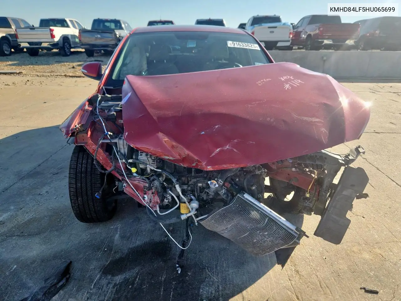KMHD84LF5HU065699 2017 Hyundai Elantra Se