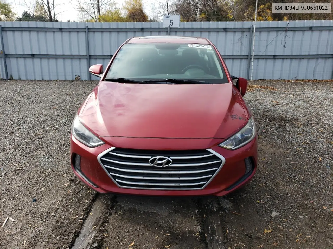 KMHD84LF9JU651022 2018 Hyundai Elantra Sel