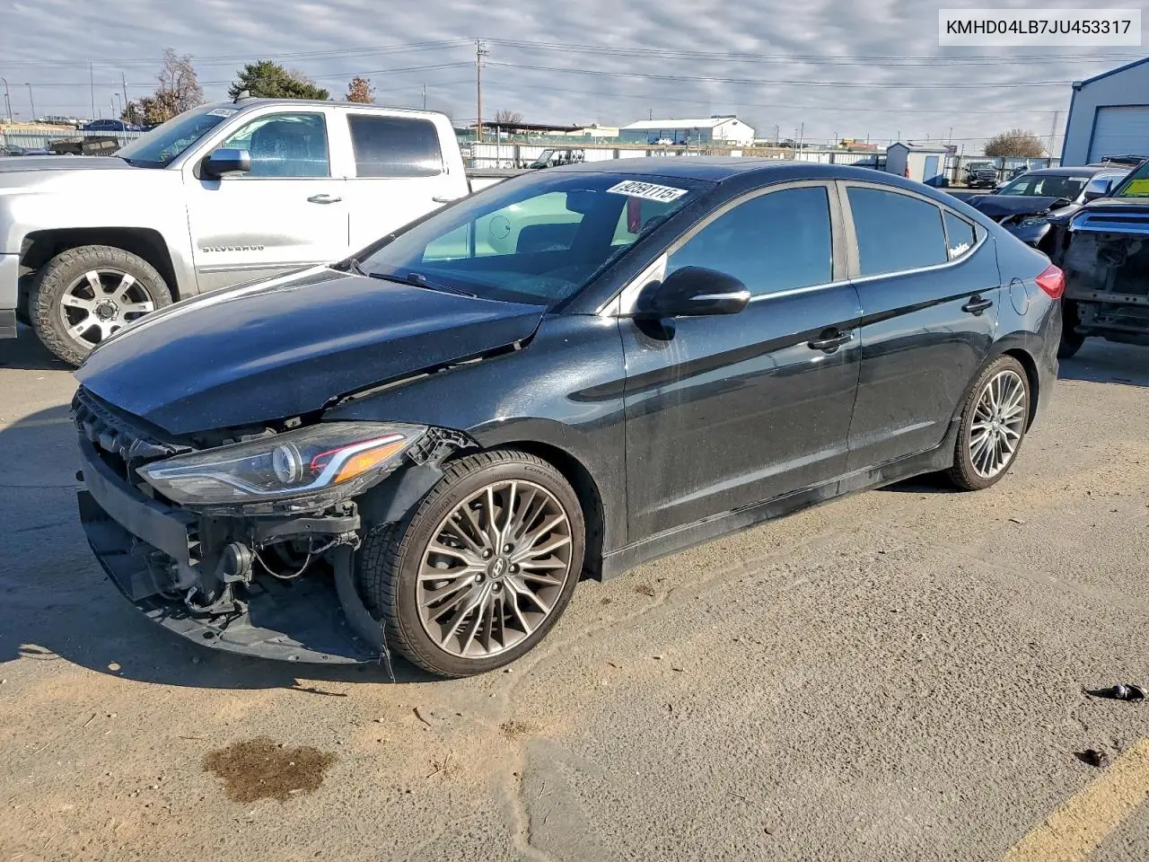 KMHD04LB7JU453317 2018 Hyundai Elantra Sport