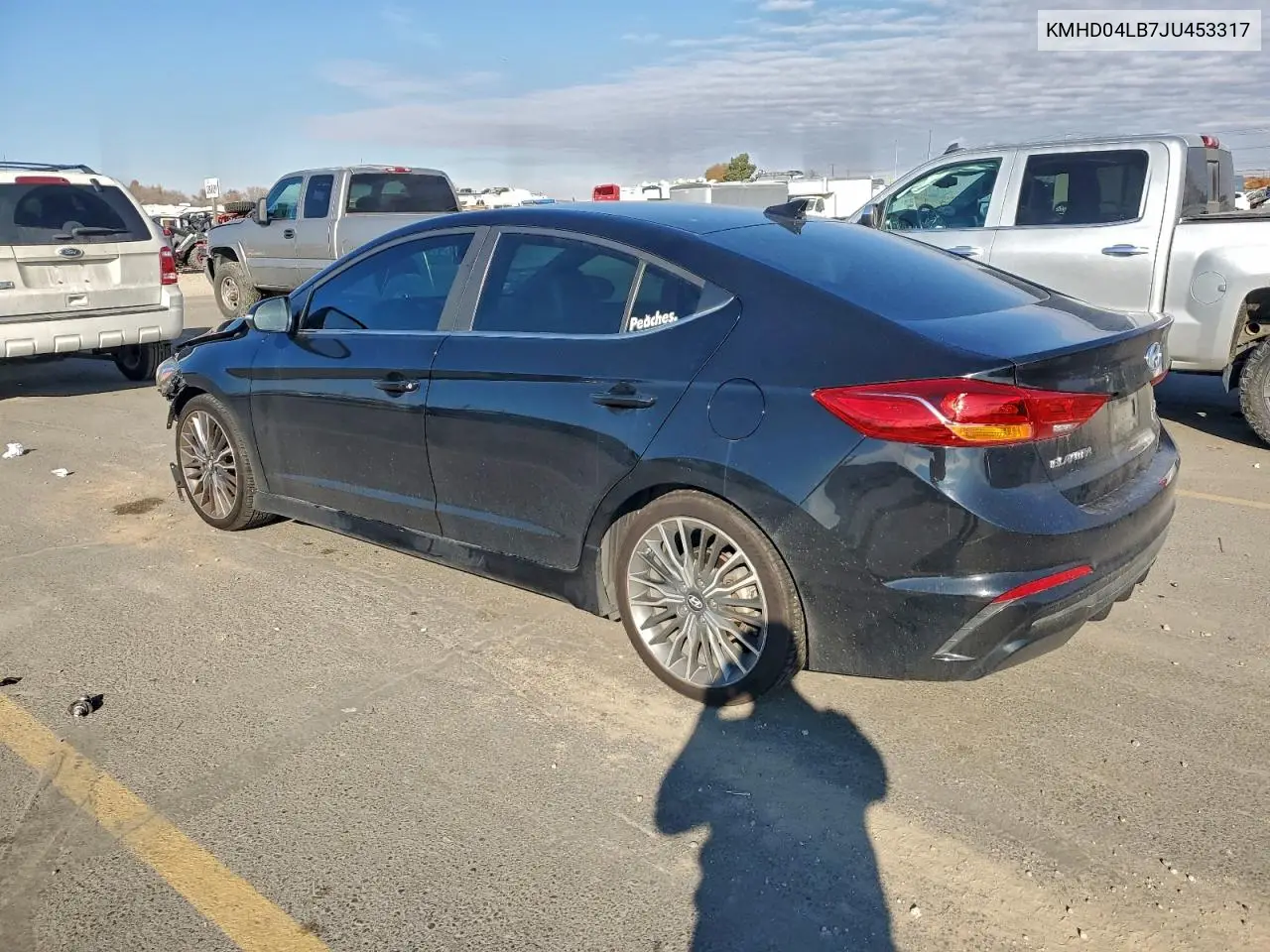 KMHD04LB7JU453317 2018 Hyundai Elantra Sport