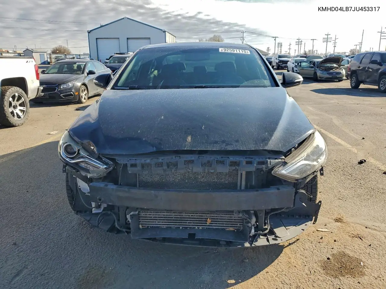KMHD04LB7JU453317 2018 Hyundai Elantra Sport