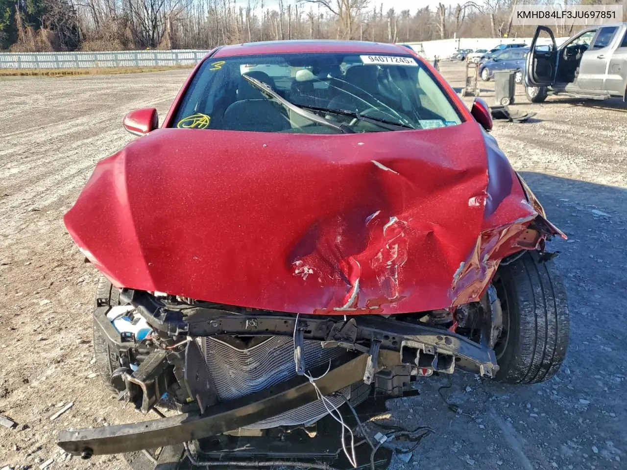 KMHD84LF3JU697851 2018 Hyundai Elantra Sel