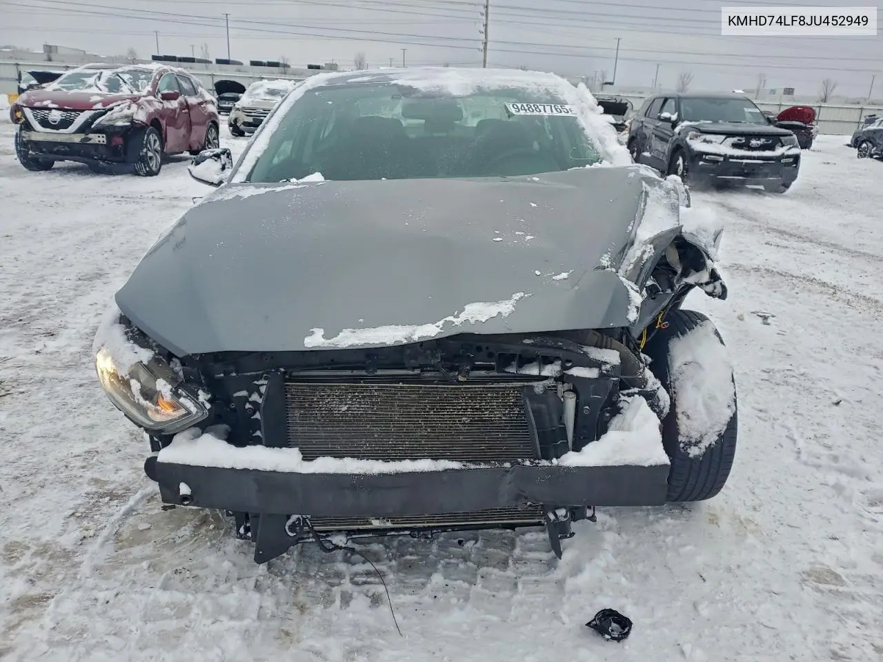 KMHD74LF8JU452949 2018 Hyundai Elantra Se