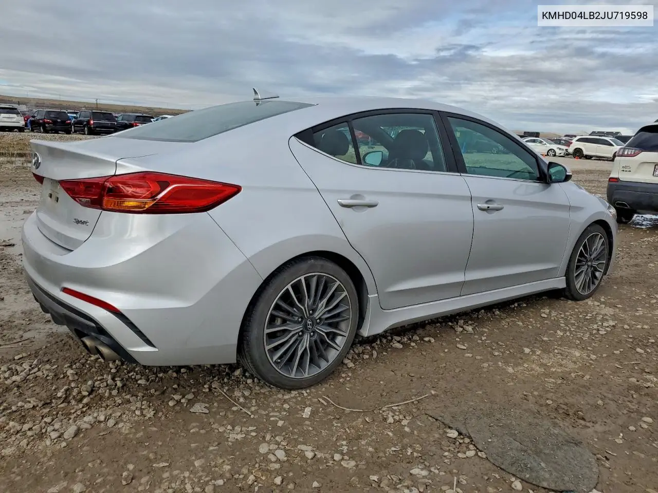 KMHD04LB2JU719598 2018 Hyundai Elantra Sport