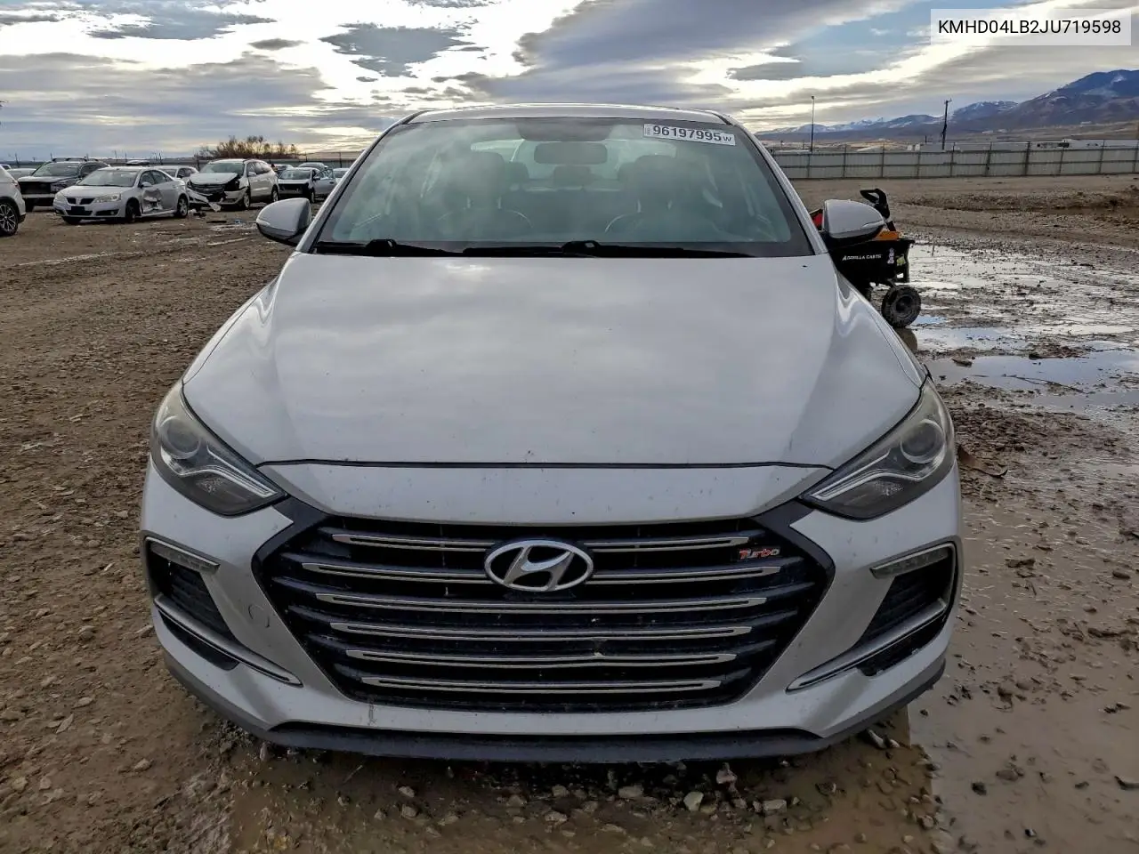 KMHD04LB2JU719598 2018 Hyundai Elantra Sport