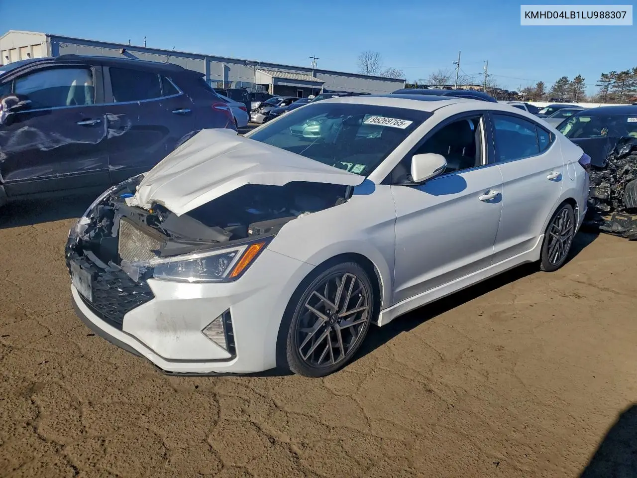 KMHD04LB1LU988307 2020 Hyundai Elantra Sport