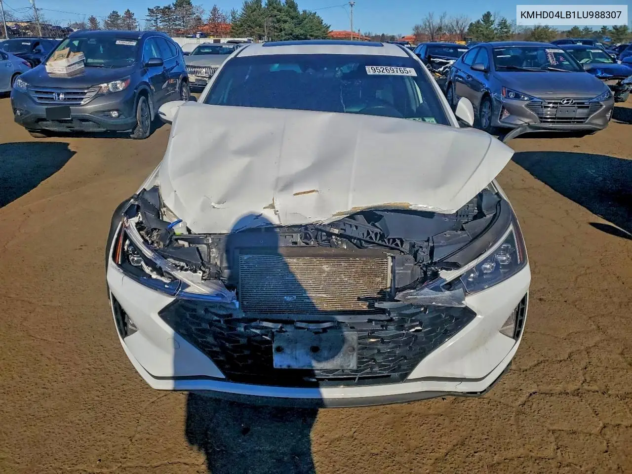 KMHD04LB1LU988307 2020 Hyundai Elantra Sport