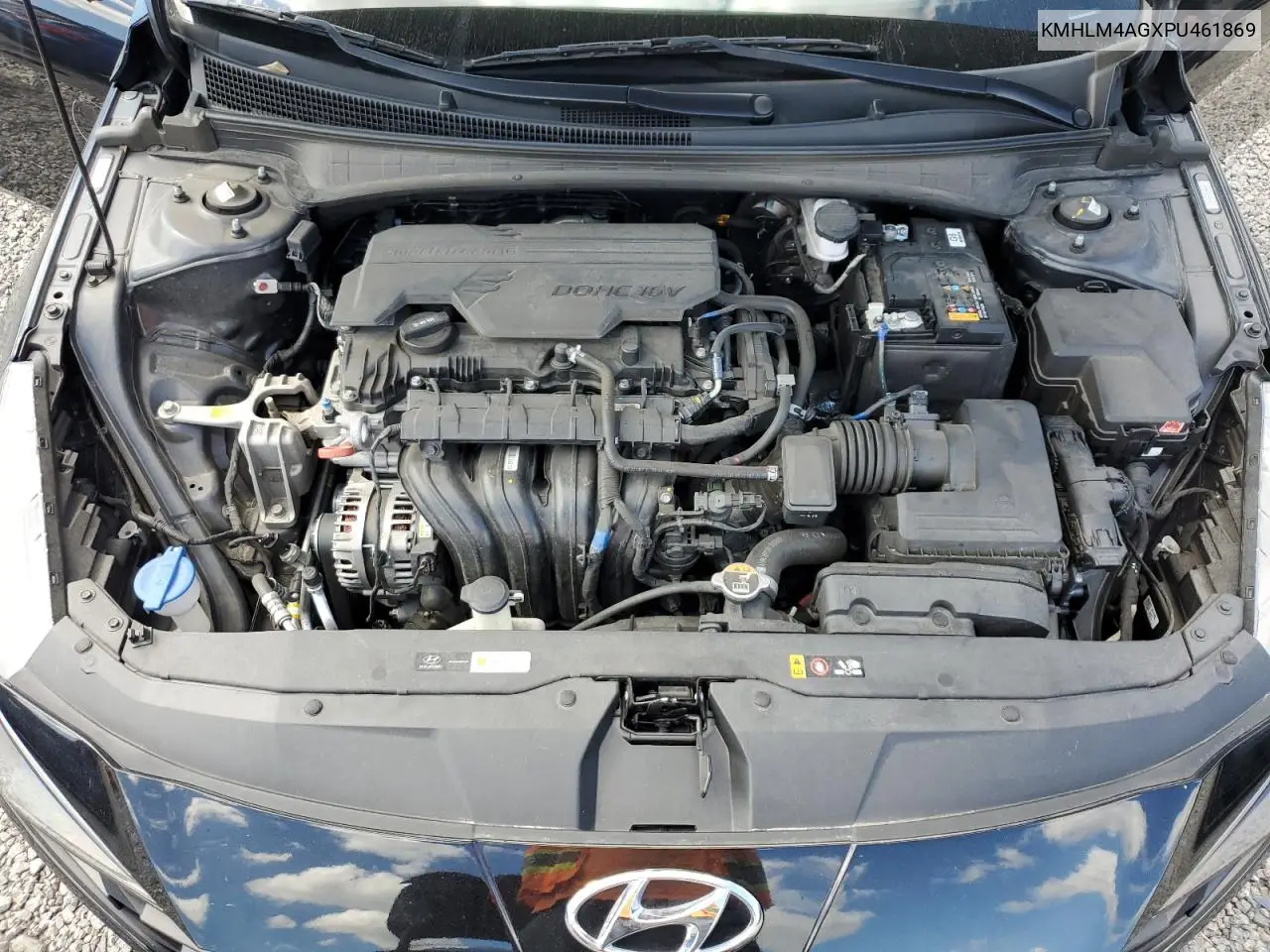 KMHLM4AGXPU461869 2023 Hyundai Elantra Sel