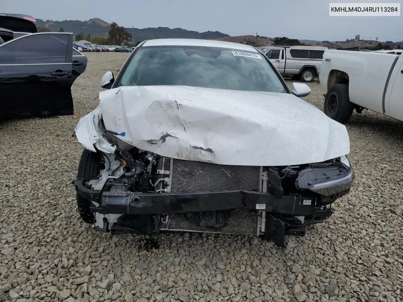 KMHLM4DJ4RU113284 2024 Hyundai Elantra Blue