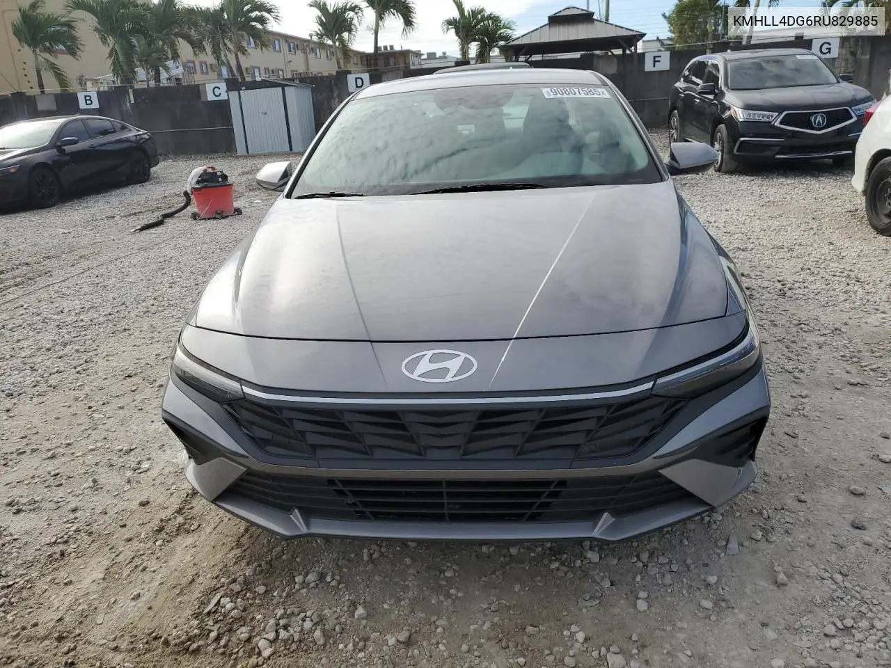 KMHLL4DG6RU829885 2024 Hyundai Elantra Se