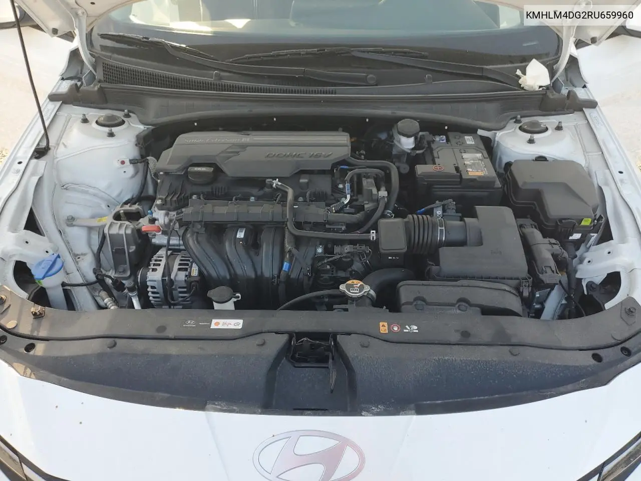KMHLM4DG2RU659960 2024 Hyundai Elantra Sel