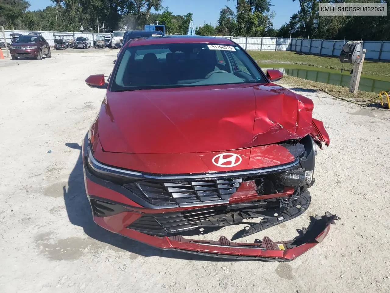 KMHLS4DG5RU832053 2024 Hyundai Elantra Sel