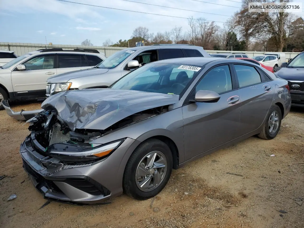 KMHLL4DG3RU657136 2024 Hyundai Elantra Se