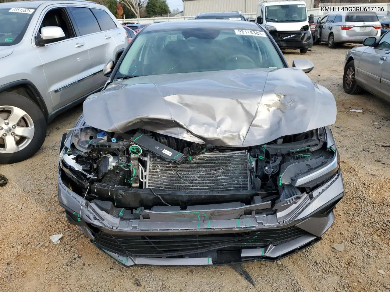 KMHLL4DG3RU657136 2024 Hyundai Elantra Se