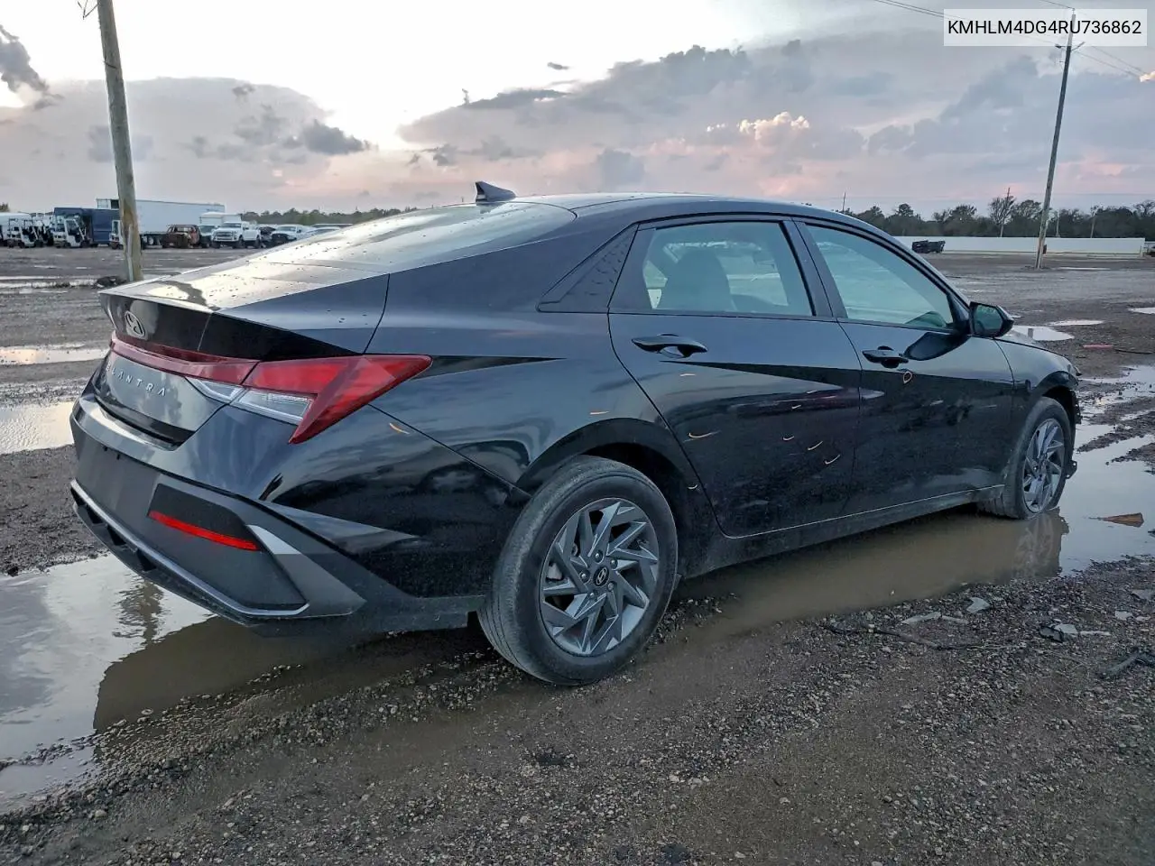 KMHLM4DG4RU736862 2024 Hyundai Elantra Sel