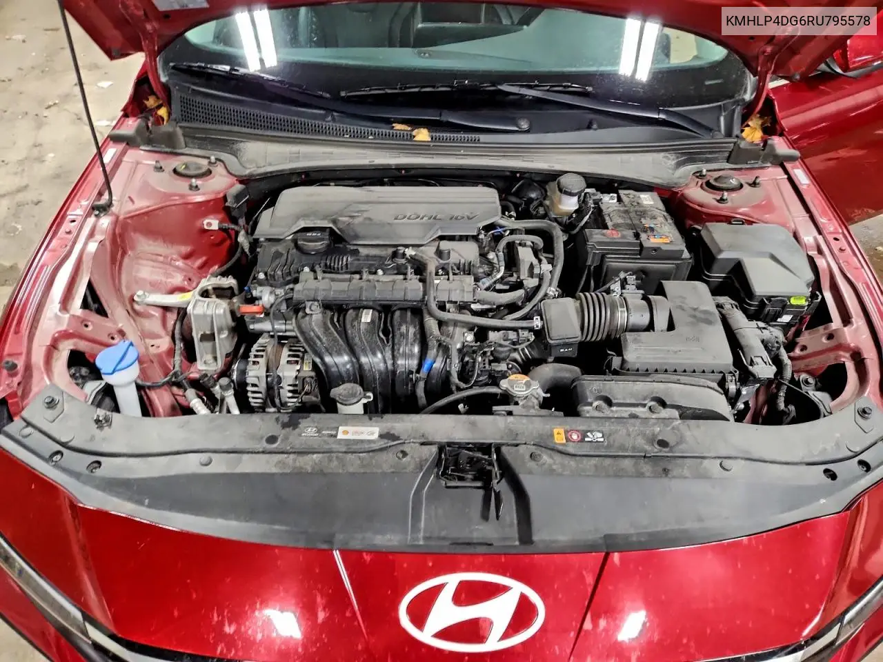 KMHLP4DG6RU795578 2024 Hyundai Elantra Limited