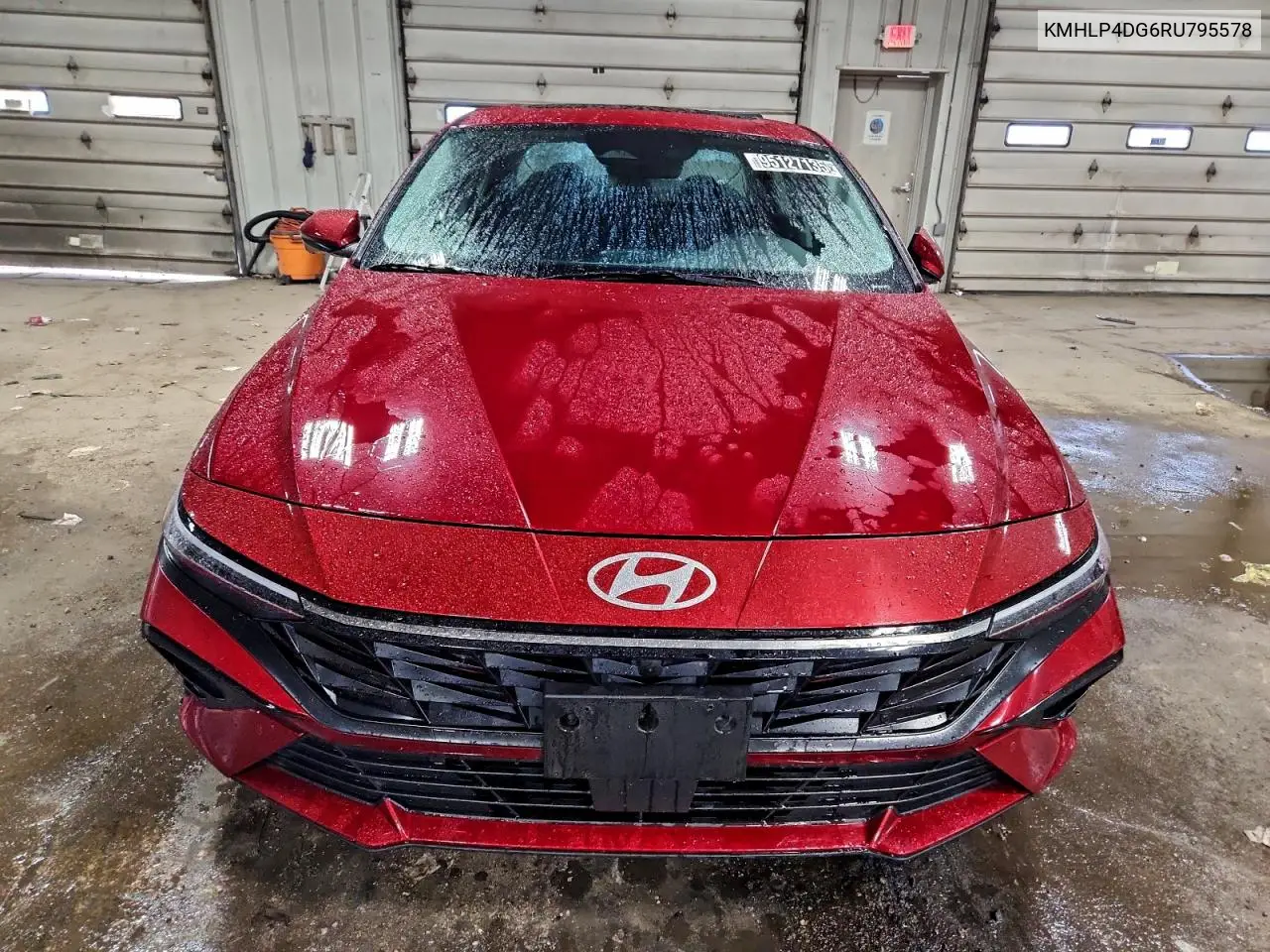 KMHLP4DG6RU795578 2024 Hyundai Elantra Limited
