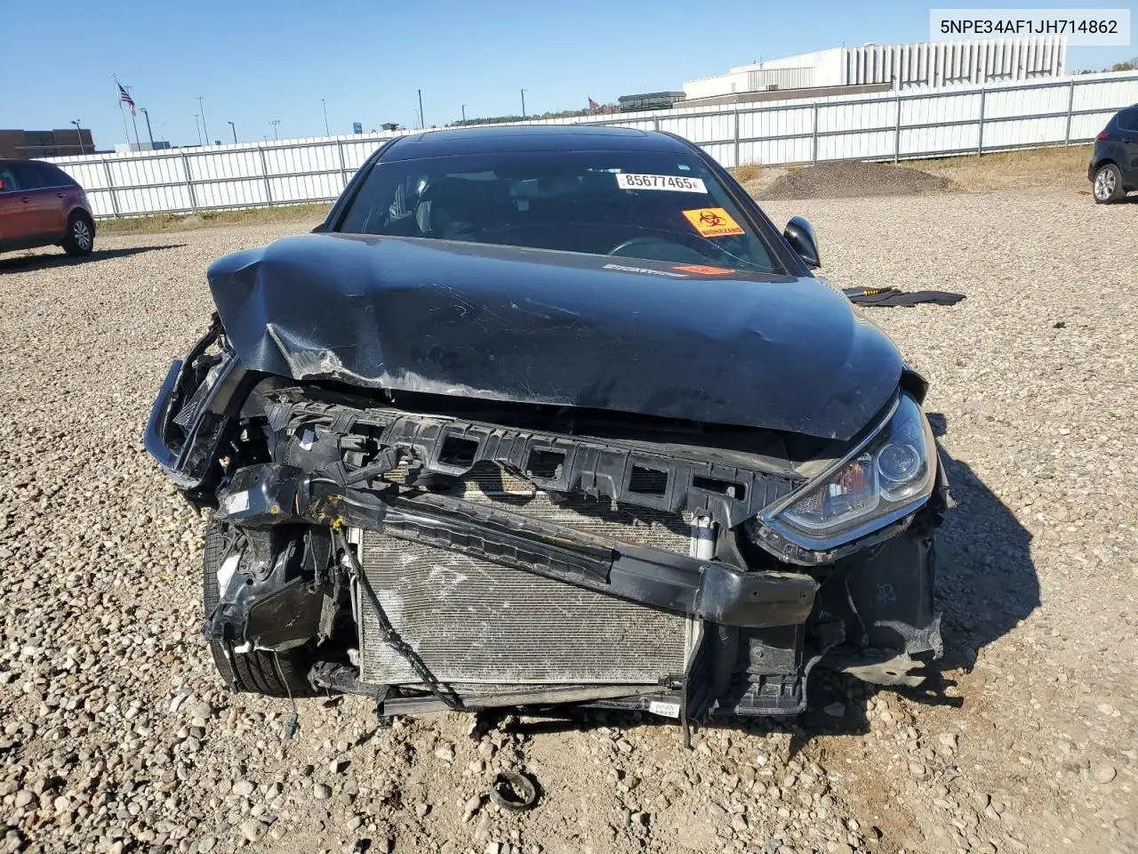 5NPE34AF1JH714862 2018 Hyundai Sonata Sport