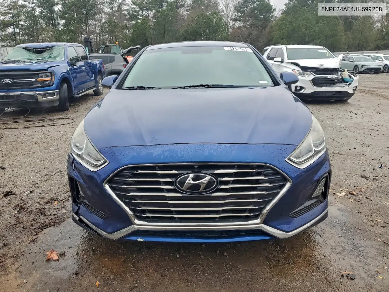 5NPE24AF4JH599208 2018 Hyundai Sonata Se