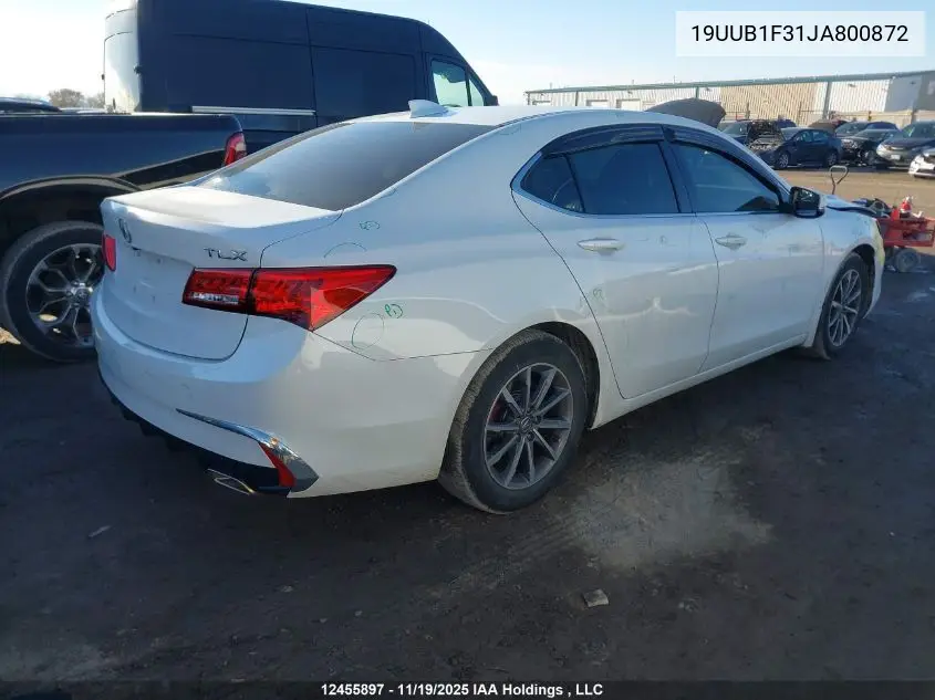 19UUB1F31JA800872 2018 Acura Tlx