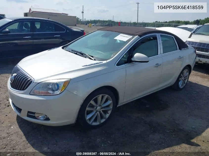 1G4PP5SK6E418559 2014 Buick Verano