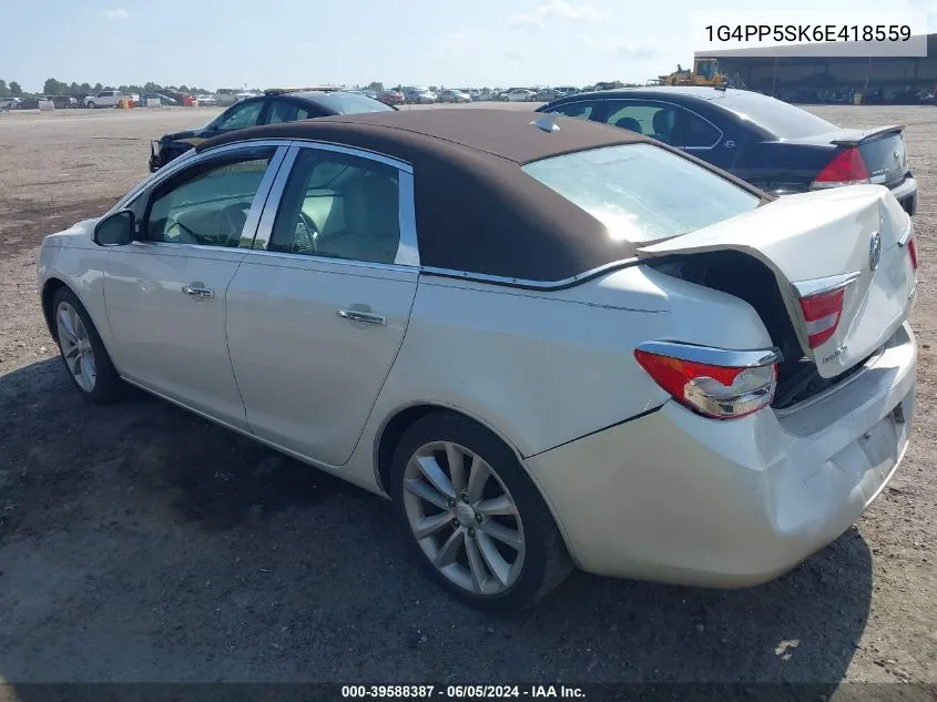 1G4PP5SK6E418559 2014 Buick Verano