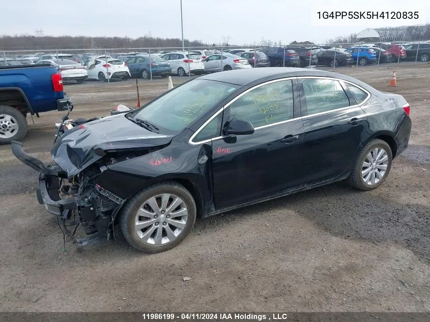 1G4PP5SK5H4120835 2017 Buick Verano