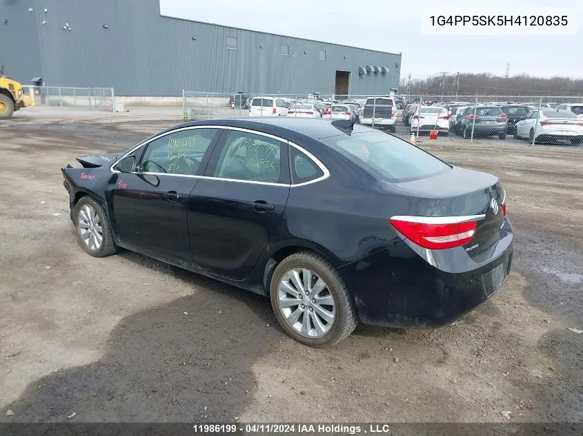 1G4PP5SK5H4120835 2017 Buick Verano