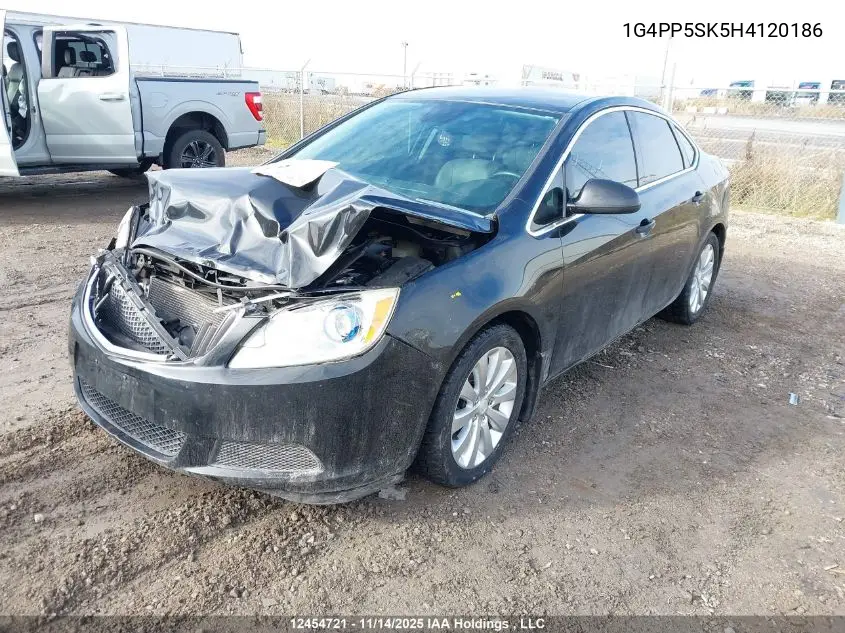 1G4PP5SK5H4120186 2017 Buick Verano