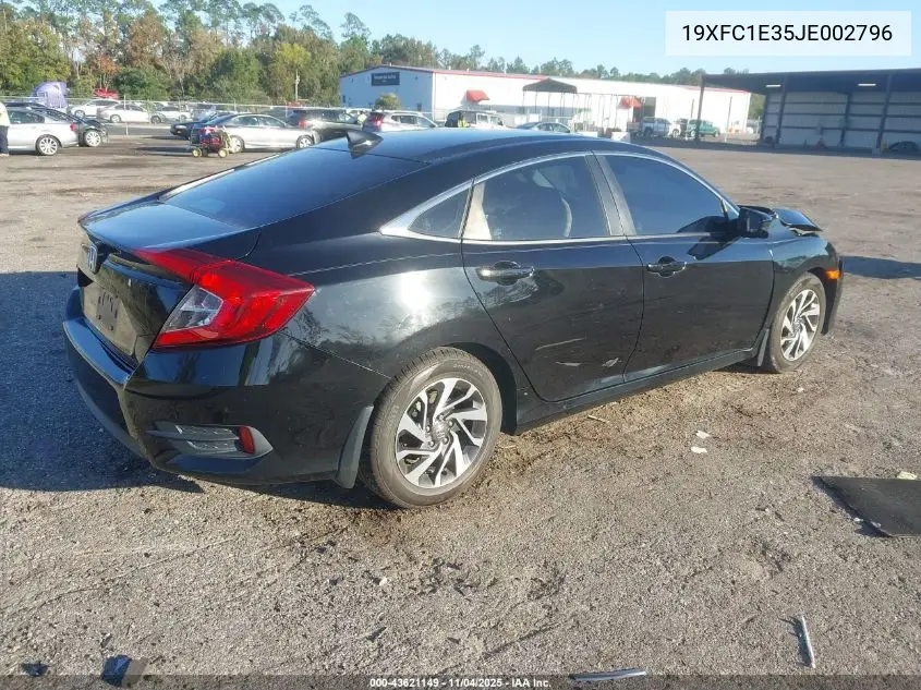 19XFC1E35JE002796 2018 Honda Civic Ex-T