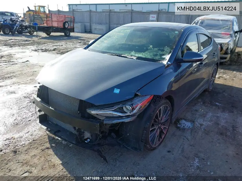 KMHD04LBXJU514224 2018 Hyundai Elantra Sport