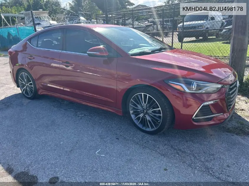 KMHD04LB2JU498178 2018 Hyundai Elantra Sport