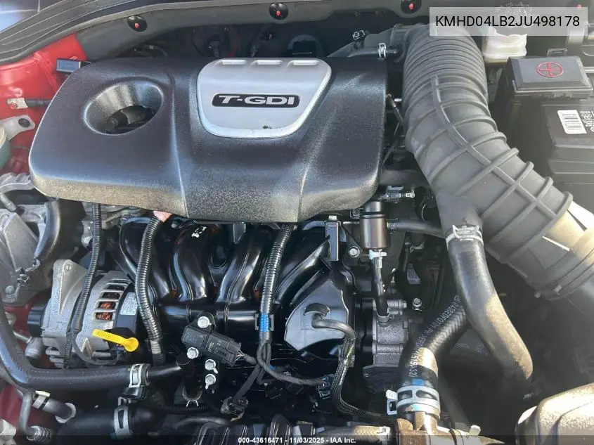 KMHD04LB2JU498178 2018 Hyundai Elantra Sport
