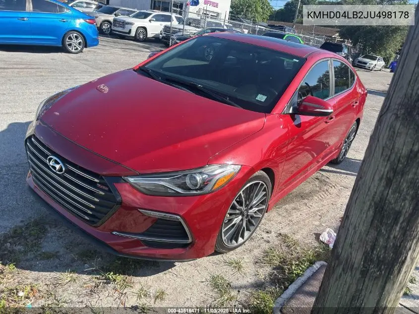 KMHD04LB2JU498178 2018 Hyundai Elantra Sport