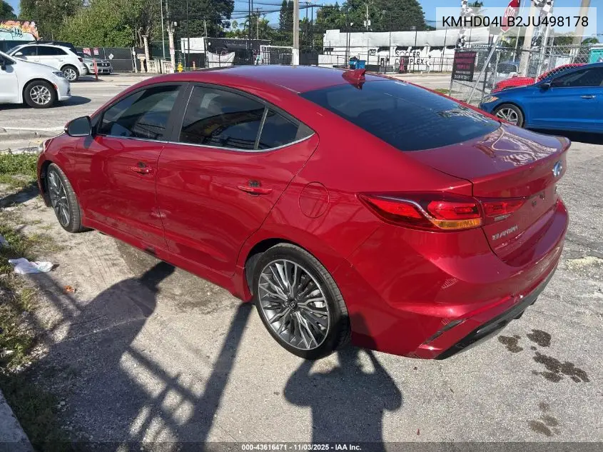 KMHD04LB2JU498178 2018 Hyundai Elantra Sport