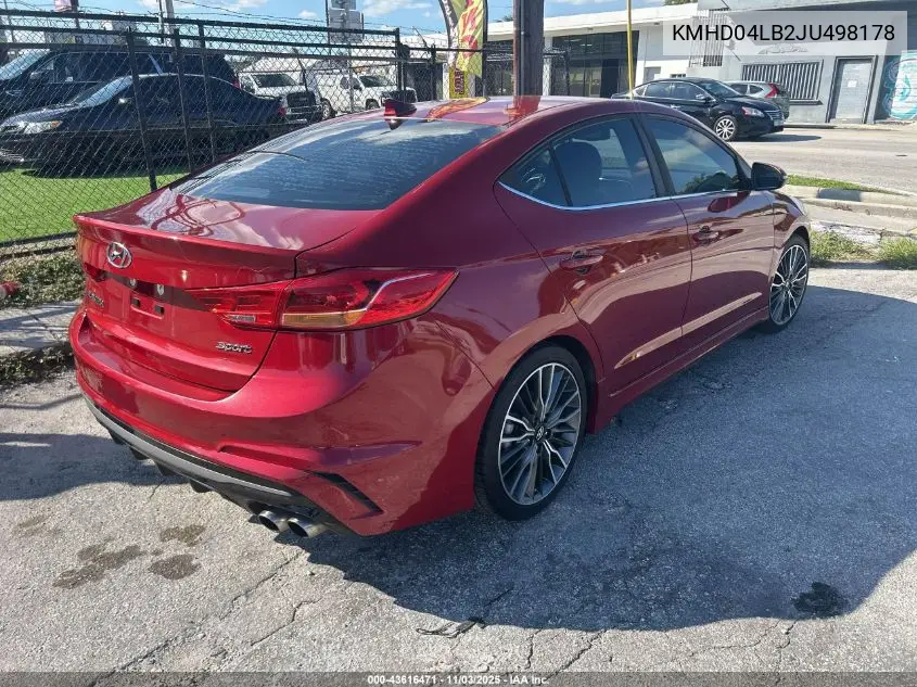 KMHD04LB2JU498178 2018 Hyundai Elantra Sport