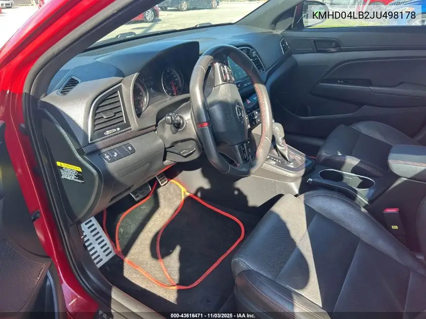 KMHD04LB2JU498178 2018 Hyundai Elantra Sport