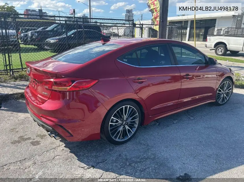 KMHD04LB2JU498178 2018 Hyundai Elantra Sport