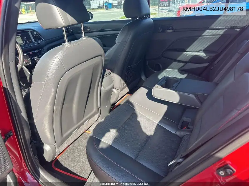 KMHD04LB2JU498178 2018 Hyundai Elantra Sport