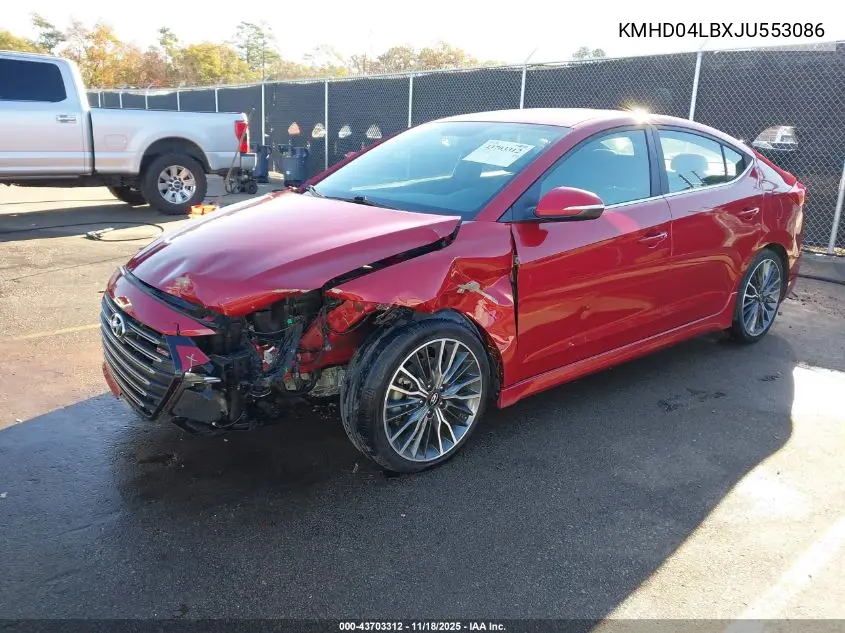 KMHD04LBXJU553086 2018 Hyundai Elantra Sport