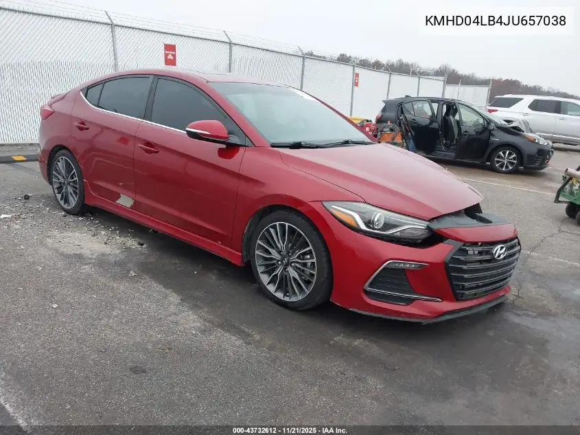 KMHD04LB4JU657038 2018 Hyundai Elantra Sport